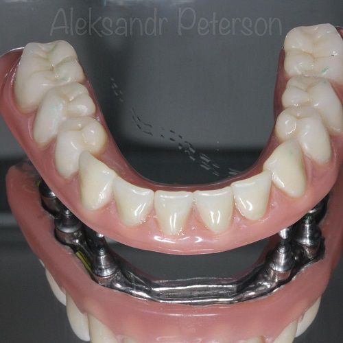Do you have removable dentures and are you afraid that they will fall out at the wrong time? фото 2