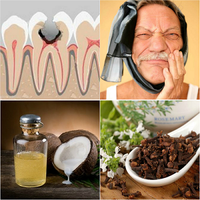 Continuation of the article about folk remedies in dentistry in acute situations. фото 2