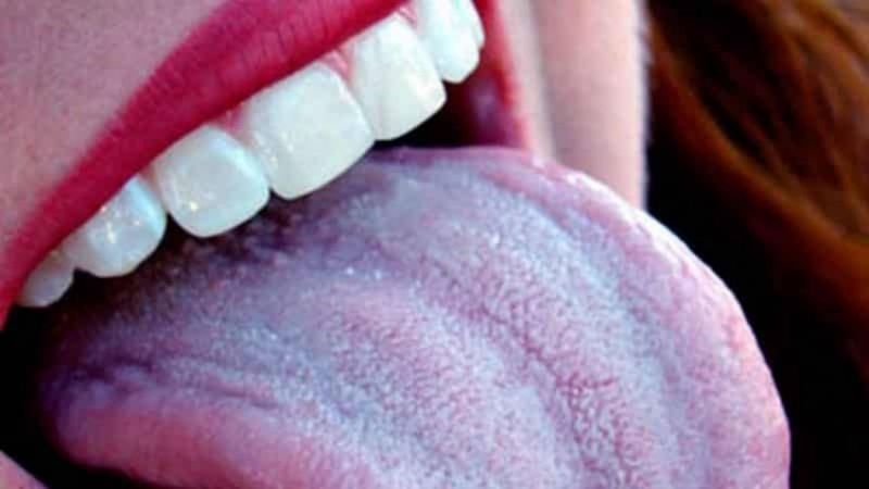 Белый налет на языке фото 1